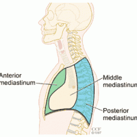 13792_mediatinal_tumors