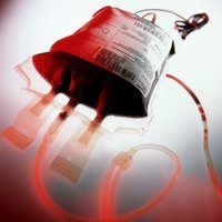 Изследване на антимитохондриални  антитела,първична билиарна цироза,хронични автоимунни хепатити,